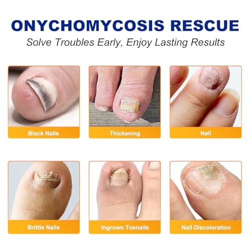 Toenail Treatment Extra Strength, 32 Patch Nail Patches for Nail Treatment Overnight, Nail Repair for Damaged Nails, Nails Care Supplies, Restore Discoloration (32 Patch)