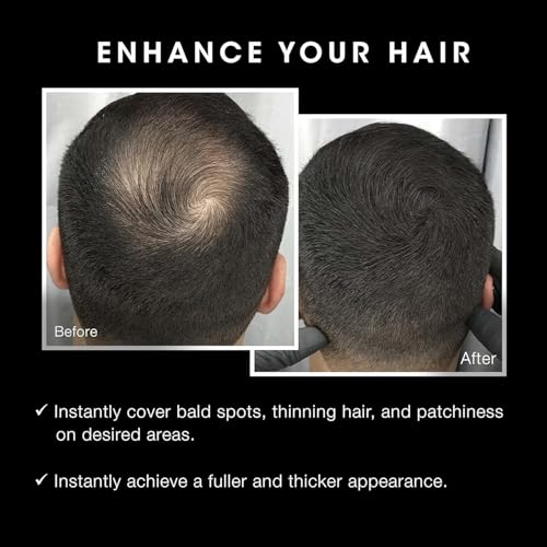 Pacinos Hair Fiber Kit - Conceal Thinning Hair Instantly with Fiber Hold Spray - Dark Brown