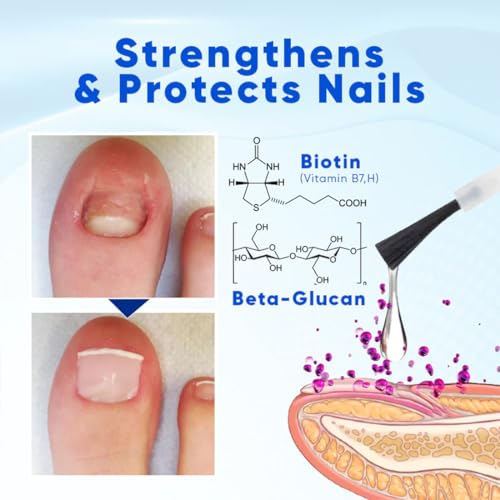 OnyxoGuard Nail Growth and Repair Serum,Nail Strengthener for Thin Nail, Brittle & Damaged Strengthener Base Coat Nail Polish Repair Nail Growth Treatment, Crystal Clear (2PCS)