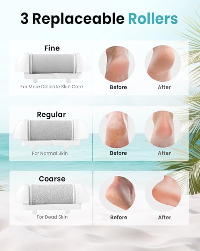 Electric Foot Callus Remover with 10000 RPM Motor and 3-Speed Settings, Foot File Kit with LED Light and Display for Women’s Home Pedicure, Waterproof Foot Grinder with Type-C Charging