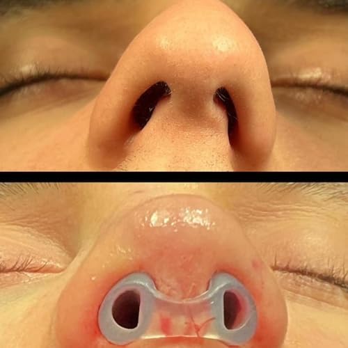 Nostril Retainer Short Model | Nostril Retainer Rhinoplasty | Nasal Retainer Rhinoplasty & Nose Splint for Rhinoplasty Recovery | 100% High Grade Silicone | Nostril Retainer Size (7)