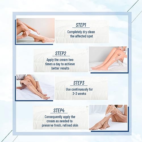 Urea Cream, 40 percent Foot Care Lotion for Cracked Heels,Cracked Heels, Ultra,Rough, Dry, Calloused Feet,Softening Rough skin on feet 5.29 fl.oz for All Skin