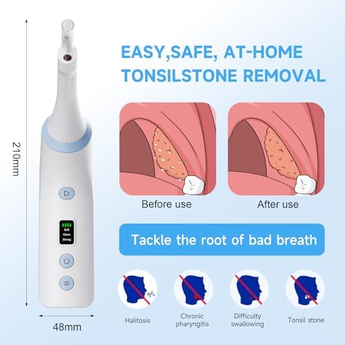 Electronic Tonsil Stone Remover with Camera, Tonsil Stone Removal Kit, 3 Suction Levels, Tonsil Stone Vacuum, Oral Care for Mouth Health, USB Rechargeable
