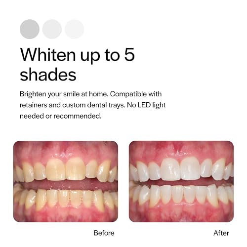 Opalescence 10% Teeth Whitening Kit - Gel Syringes Refills - Low Sensitivy (4 Packs / 8 Units) - Fluoride, Carbamide Peroxide - Made in The USA by Ultradent 5211-4