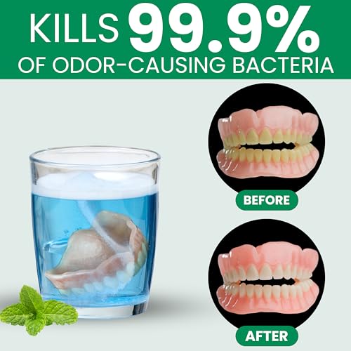 Pro Tech Retainer Cleaner - 180-220 Cleanings (0.17 Per Cleaning) 22 Pack/6 Month Supply - For Clear Aligners, Dentures, Retainers, Mouth Guards & Night Guards - Cleaning Crystals, Mint