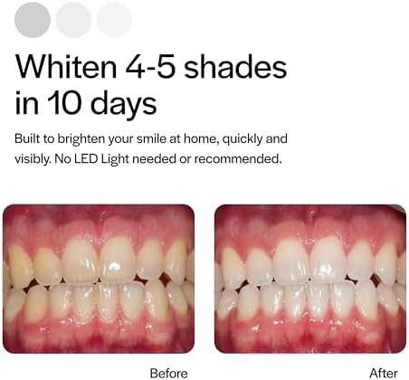 Opalescence Go - Prefilled Teeth Whitening Trays - Original 15% - (4 Treatments) - Hydrogen Peroxide with PF - Cool Mint - Made by Ultradent. 4648-1