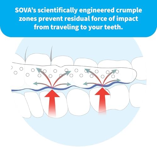 SOVA Aero Night Guard - 1.6mm Thin - Custom-Molded Fit - Protects Against Nighttime Teeth Grinding & Clenching - FSA/HSA Eligible - Odor & Taste Free - Remoldable Up to 20 Times - Non Toxic
