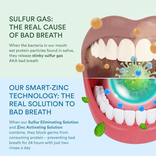 SmartMouth Dry Mouth Rinse Single Pack – 50 Pack