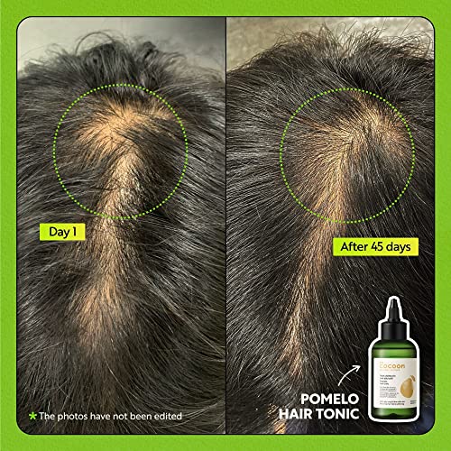 Cocoon Pomelo Grapefruit Oil Hair Tonic, Hair Growth Serum, Vegan Scalp Serum Treatment for Thinning, Damaged & Breakage Hair | Soften, Reduce Hair Loss & Promote Hair Growth | 4.73 fl oz