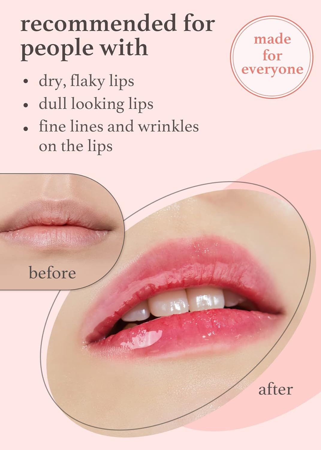 NOONI Korean Hydrating Lip Oil Applepeony + Applecoco Bundle