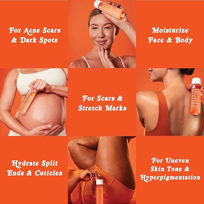 Bio-Oil Skincare Body Oil Serum for Scars and Stretch Marks, Face and Body Moisturizer with Vitamin E & A for Sensitive Dry Skin, Dermatologist Recommended, Non-Comedogenic, 4.2 Oz