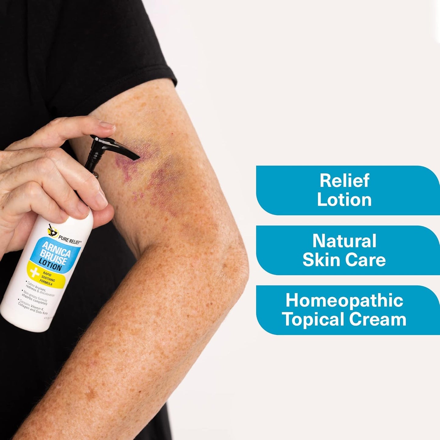 Arnica Bruise Relief Lotion for Bruising, Swelling, & Discoloration On Skin, Natural Skin Care Arnica Bruise Homeopathic Topical Bruise Cream W/Aloe Vera & Collagen, 4 Fl Oz (Pack of 2)