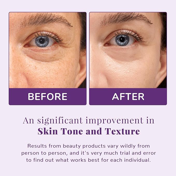 ANAI RUI Niacinamide Toner Pads,with Glutathione, Niacinamide, LHA, PHA, Facial Radiance Wipes for Even Skin Tone, Reduce Blemish and Spots 50 Pads