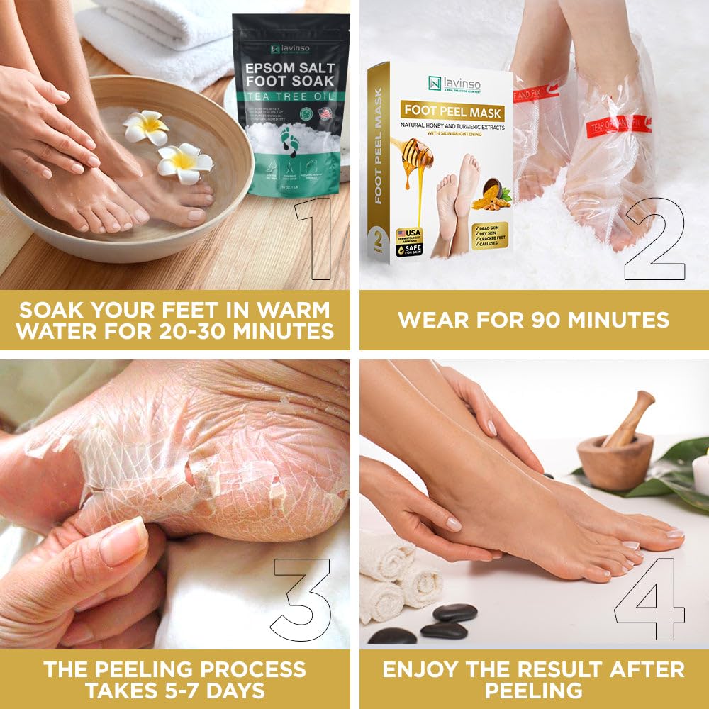 Lavinso Honey Feet Peeling Mask for Dry Cracked Feet - 2 Pack - with Kojic Acid Skin Brightening Effect - Exfoliating Dead Skin and Calluses - Foot Peel Mask for Baby Soft Feet